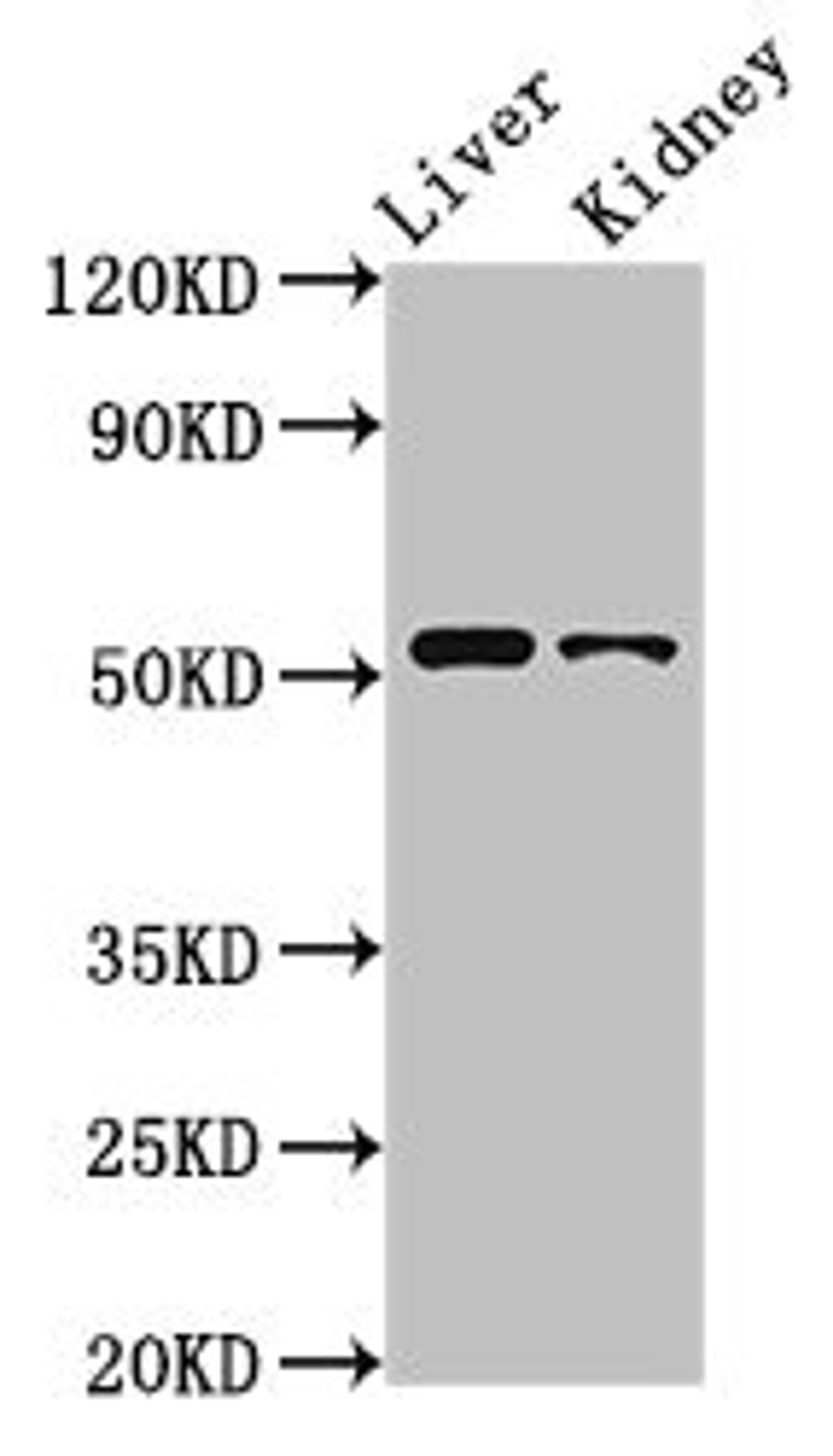 Western Blot. Positive WB detected in: Rat liver tissue, Rat kidney tissue. All lanes: PTGER4 antibody at 3.2ug/ml. Secondary. Goat polyclonal to rabbit IgG at 1/50000 dilution. Predicted band size: 54 kDa. Observed band size: 54 kDa.