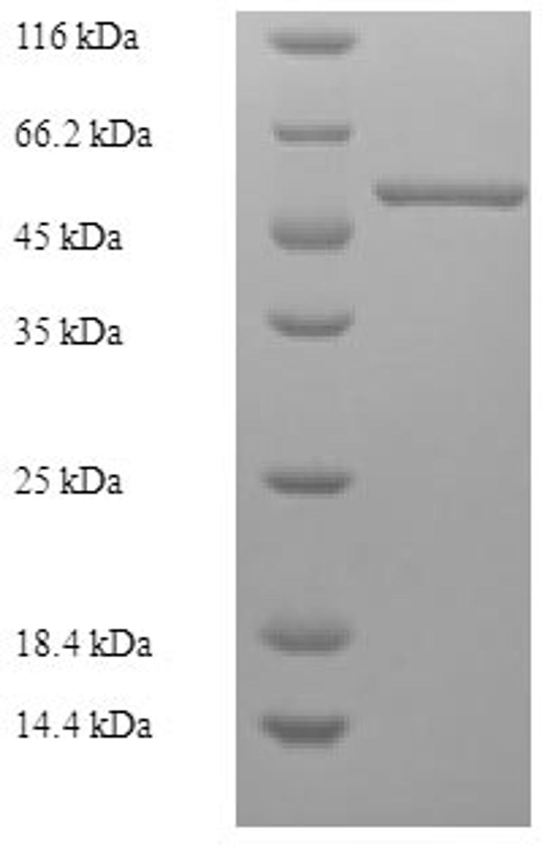 (Tris-Glycine gel) Discontinuous SDS-PAGE (reduced) with 5% enrichment gel and 15% separation gel.