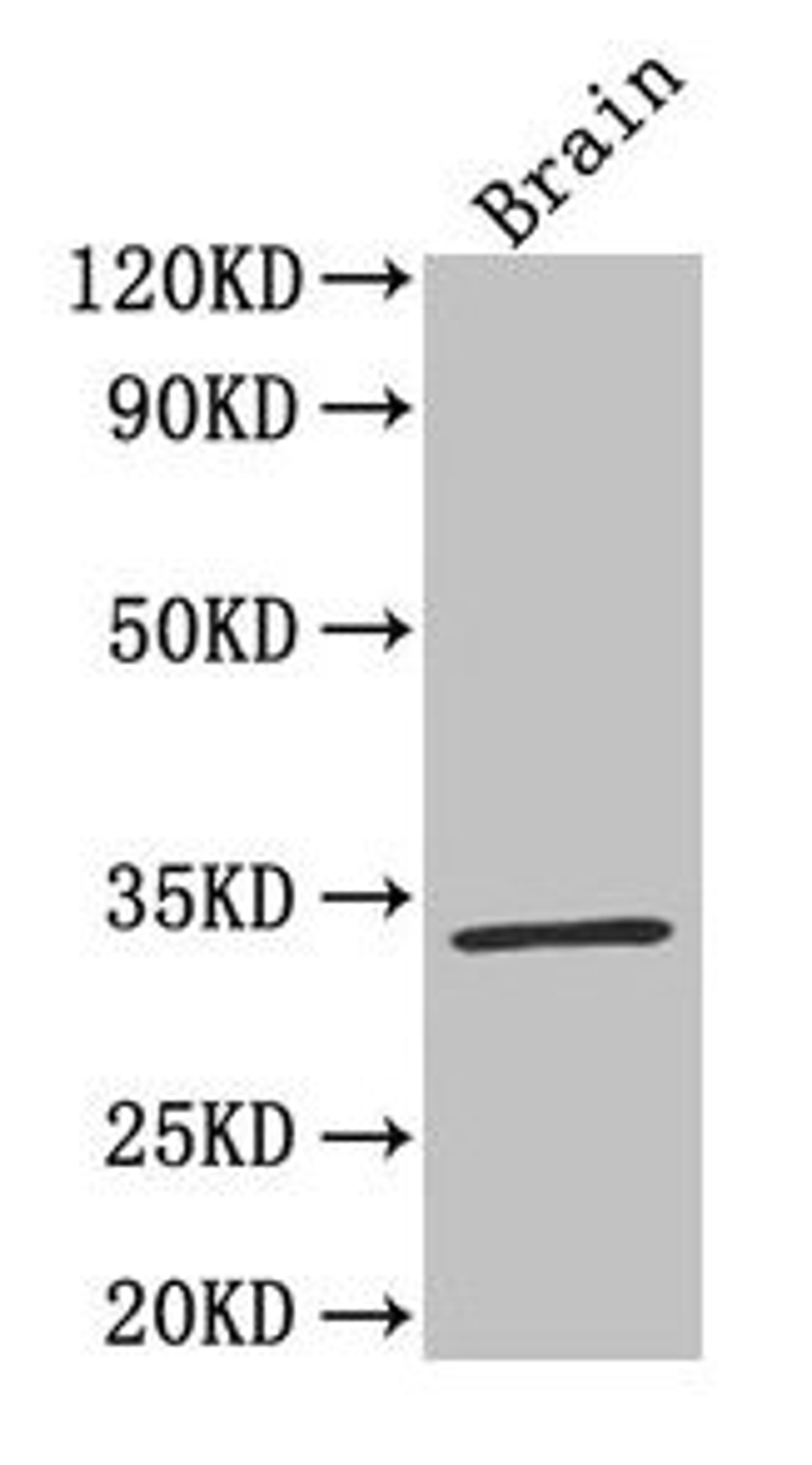 Western Blot. Positive WB detected in: Mouse brain tissue. All lanes: F3 antibody at 4µg/ml. Secondary. Goat polyclonal to rabbit IgG at 1/50000 dilution. Predicted band size: 34, 28 kDa. Observed band size: 34 kDa