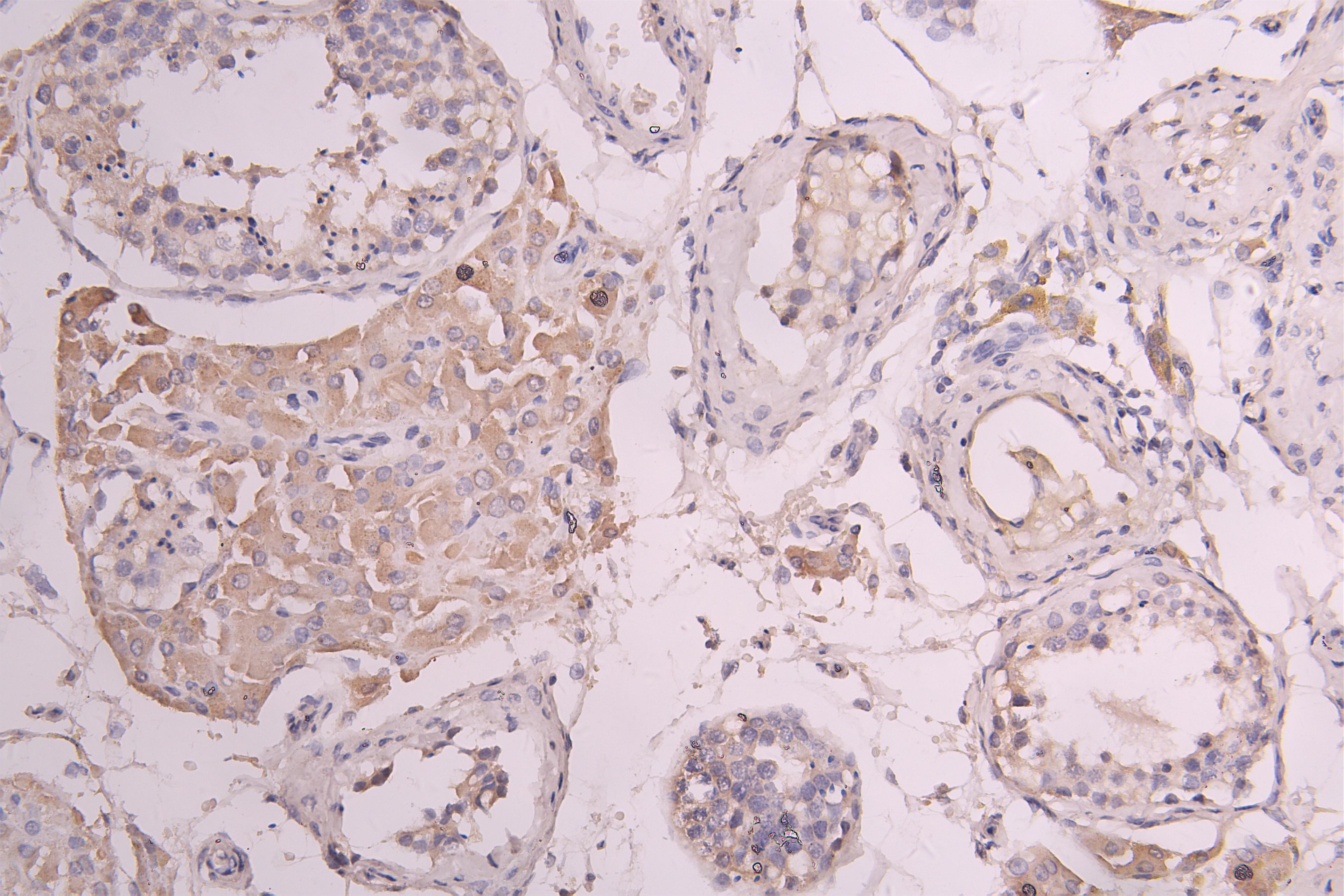 IHC image of CSB-RA860321MA1HU diluted at 1：100 and staining in paraffin-embedded human testis tissue performed on a Leica BondTM system. After dewaxing and hydration, antigen retrieval was mediated by high pressure in a citrate buffer (pH 6.0). Section was blocked with 10% normal goat serum 30min at RT. Then primary antibody (1% BSA) was incubated at 4°C overnight. The primary is detected by a Goat anti-human polymer IgG labeled by HRP and visualized using 0.05% DAB.