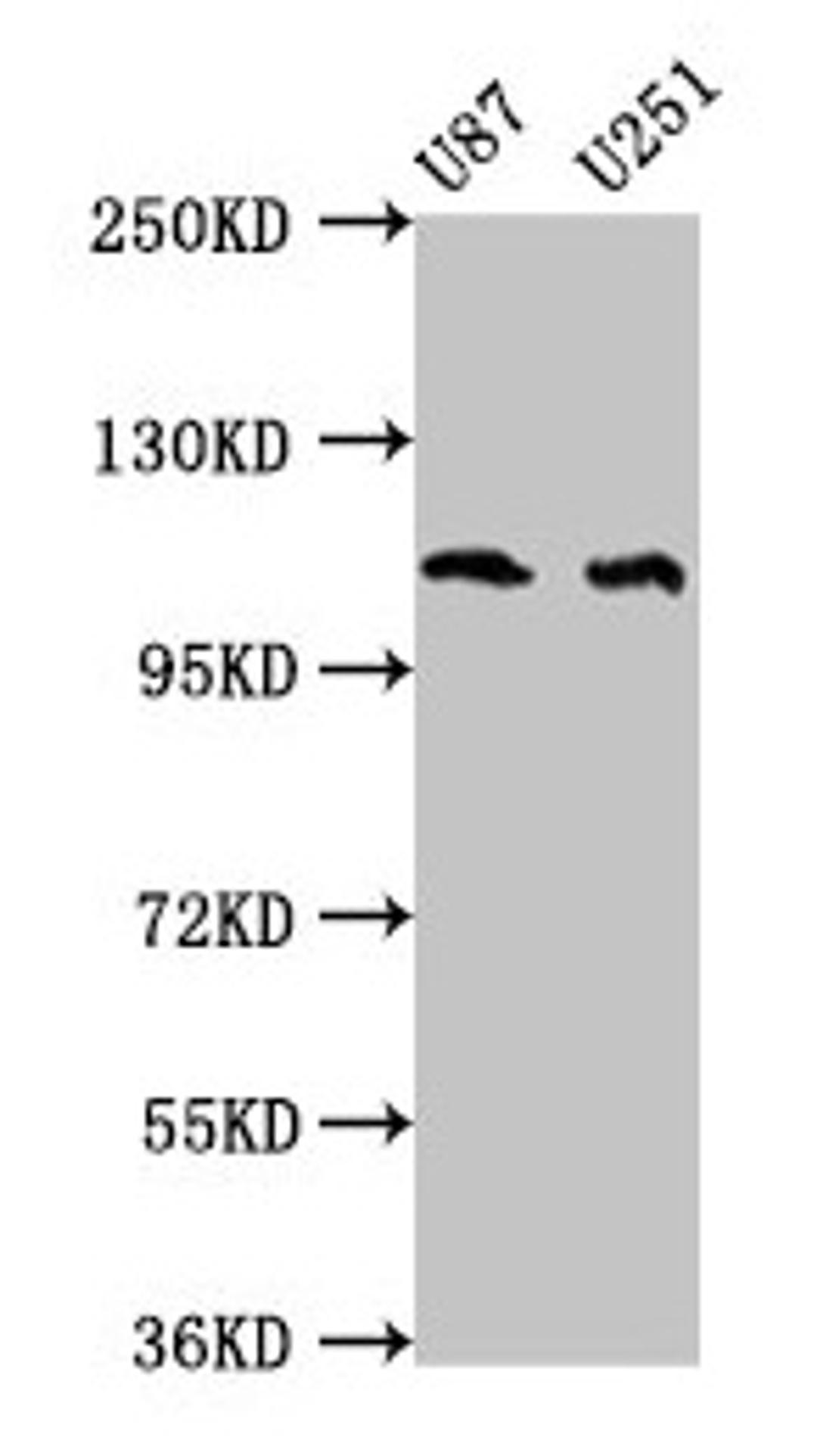 Western Blot. Positive WB detected in: U87 whole cell lysate, U251 whole cell lysate. All lanes: ABL2 antibody at 4µg/ml. Secondary. Goat polyclonal to rabbit IgG at 1/50000 dilution. Predicted band size: 129, 125, 127, 115, 118, 116, 117, 61 kDa. Observed band size: 115 kDa