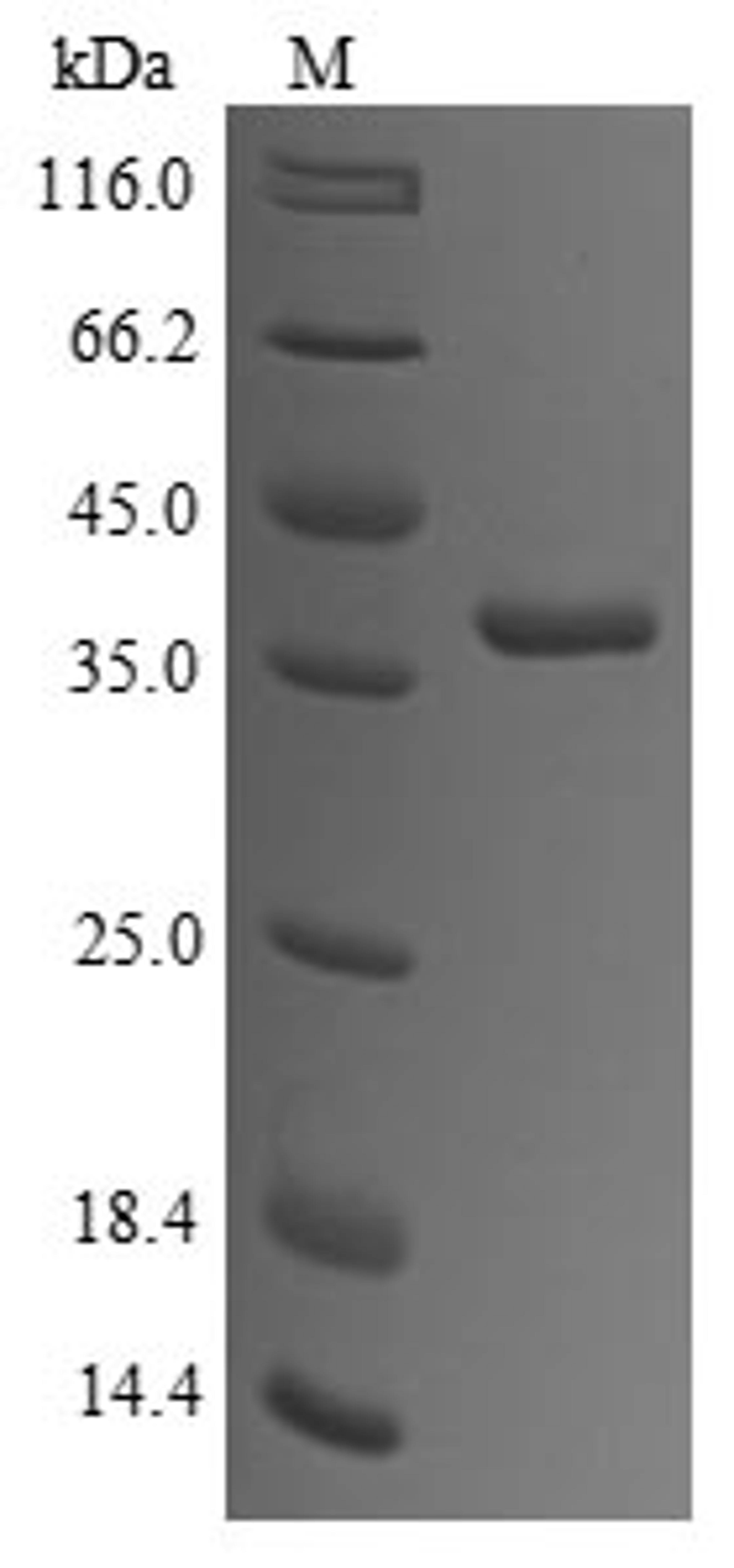 (Tris-Glycine gel) Discontinuous SDS-PAGE (reduced) with 5% enrichment gel and 15% separation gel.