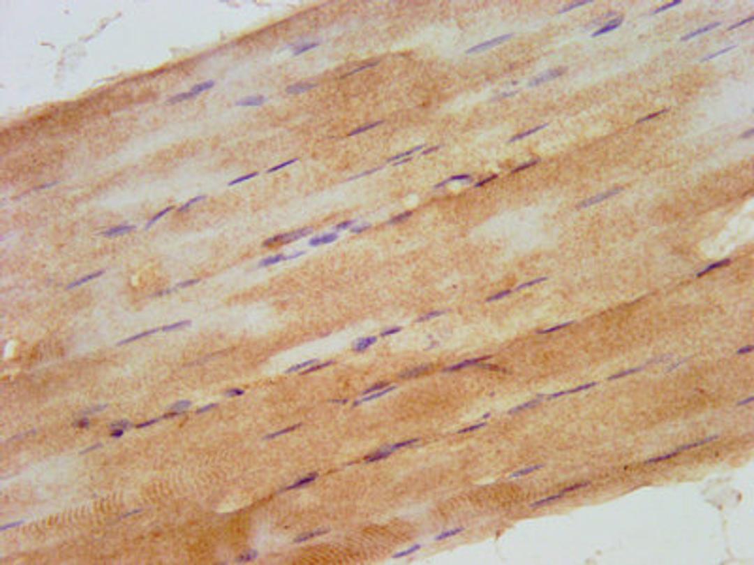 IHC image of CSB-PA745331LA01HU diluted at 1:500 and staining in paraffin-embedded human skeletal muscle tissue performed on a Leica BondTM system. After dewaxing and hydration, antigen retrieval was mediated by high pressure in a citrate buffer (pH 6.0). Section was blocked with 10% normal goat serum 30min at RT. Then primary antibody (1% BSA) was incubated at 4&deg;C overnight. The primary is detected by a biotinylated secondary antibody and visualized using an HRP conjugated SP system.