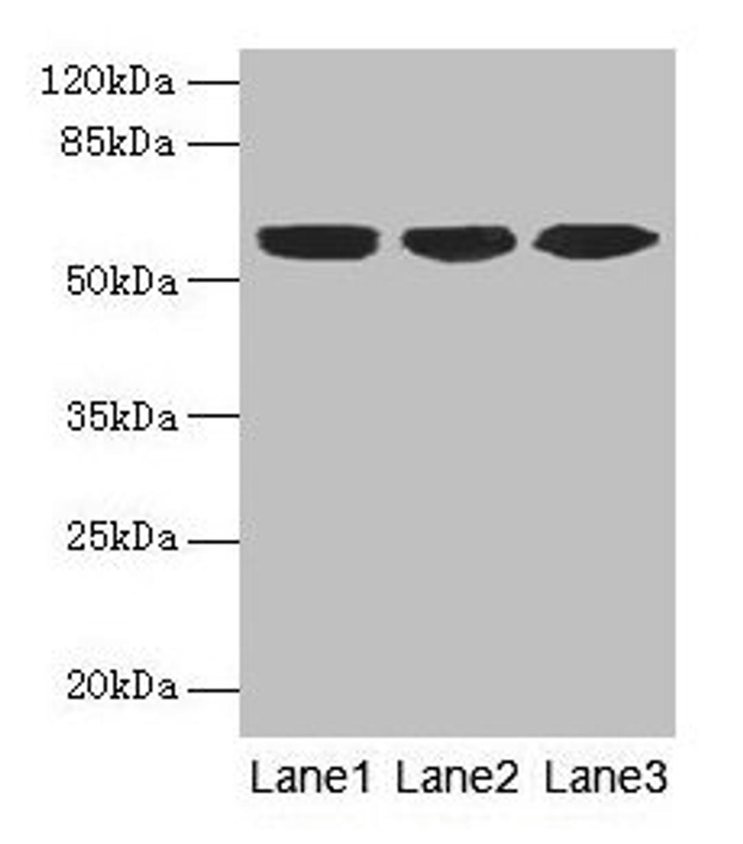 Western blot. All lanes: KRT10 antibody at 6µg/ml. Lane 1: A431 whole cell lysate. Lane 2: HepG2 whole cell lysate. Lane 3: MCF-7 whole cell lysate. Secondary. Goat polyclonal to rabbit IgG at 1/10000 dilution. Predicted band size: 59 kDa. Observed band size: 59 kDa