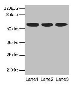 Western blot. All lanes: KRT10 antibody at 6µg/ml. Lane 1: A431 whole cell lysate. Lane 2: HepG2 whole cell lysate. Lane 3: MCF-7 whole cell lysate. Secondary. Goat polyclonal to rabbit IgG at 1/10000 dilution. Predicted band size: 59 kDa. Observed band size: 59 kDa