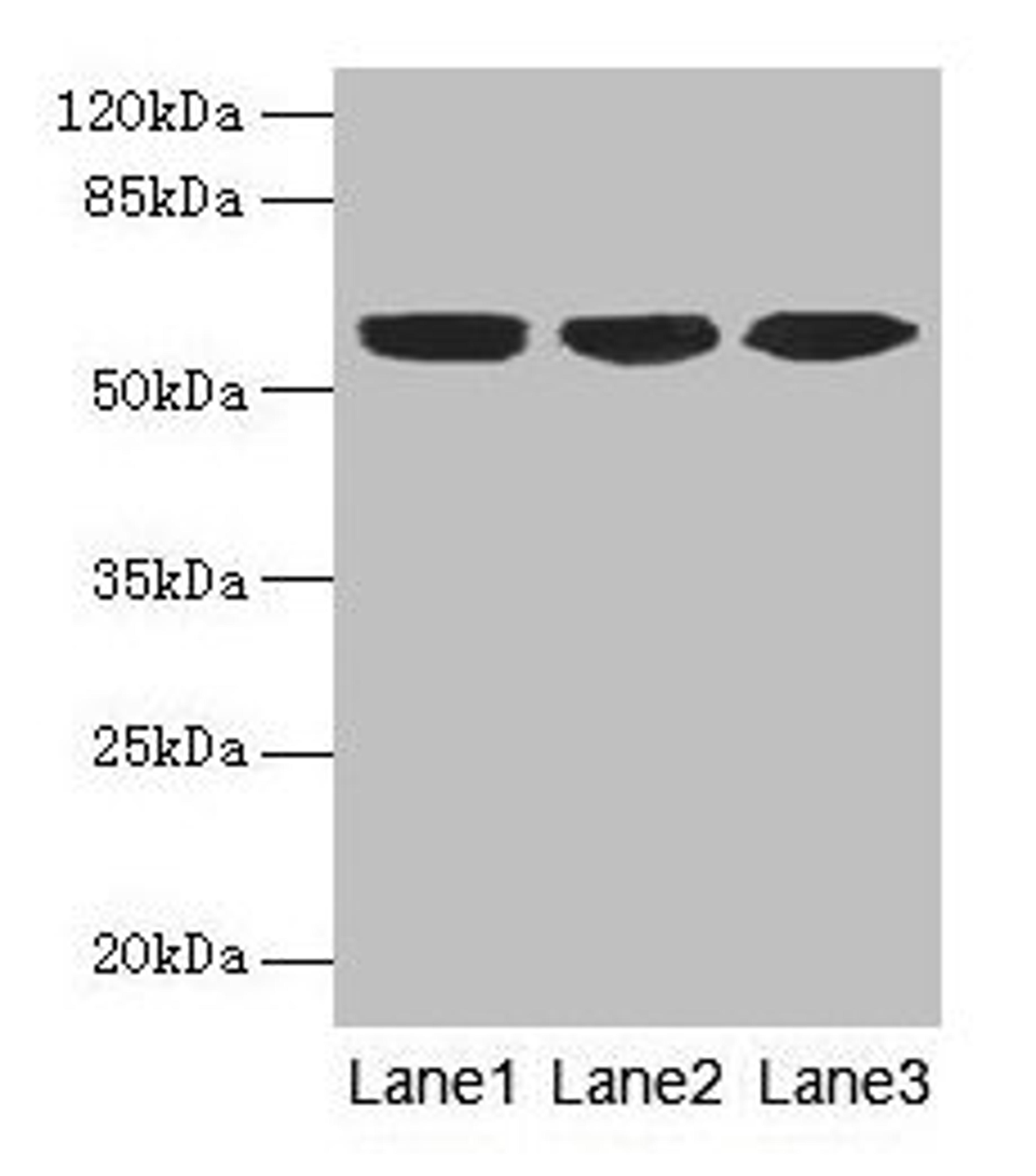 Western blot. All lanes: KRT10 antibody at 6µg/ml. Lane 1: A431 whole cell lysate. Lane 2: HepG2 whole cell lysate. Lane 3: MCF-7 whole cell lysate. Secondary. Goat polyclonal to rabbit IgG at 1/10000 dilution. Predicted band size: 59 kDa. Observed band size: 59 kDa