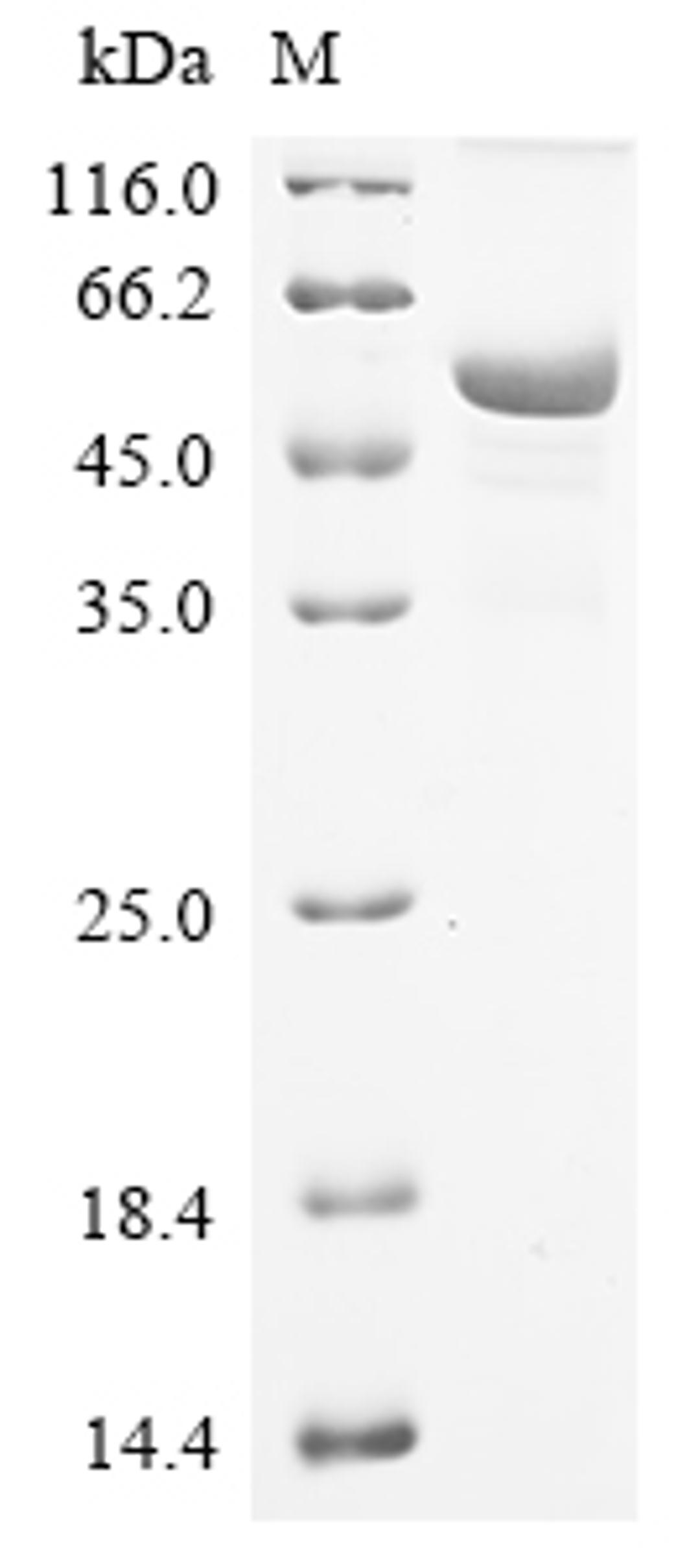 (Tris-Glycine gel) Discontinuous SDS-PAGE (reduced) with 5% enrichment gel and 15% separation gel.