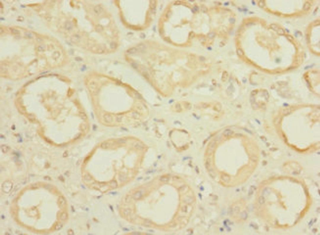 Immunohistochemistry of paraffin-embedded human kidney tissue using CSB-PA669847LA01HU at dilution of 1:100