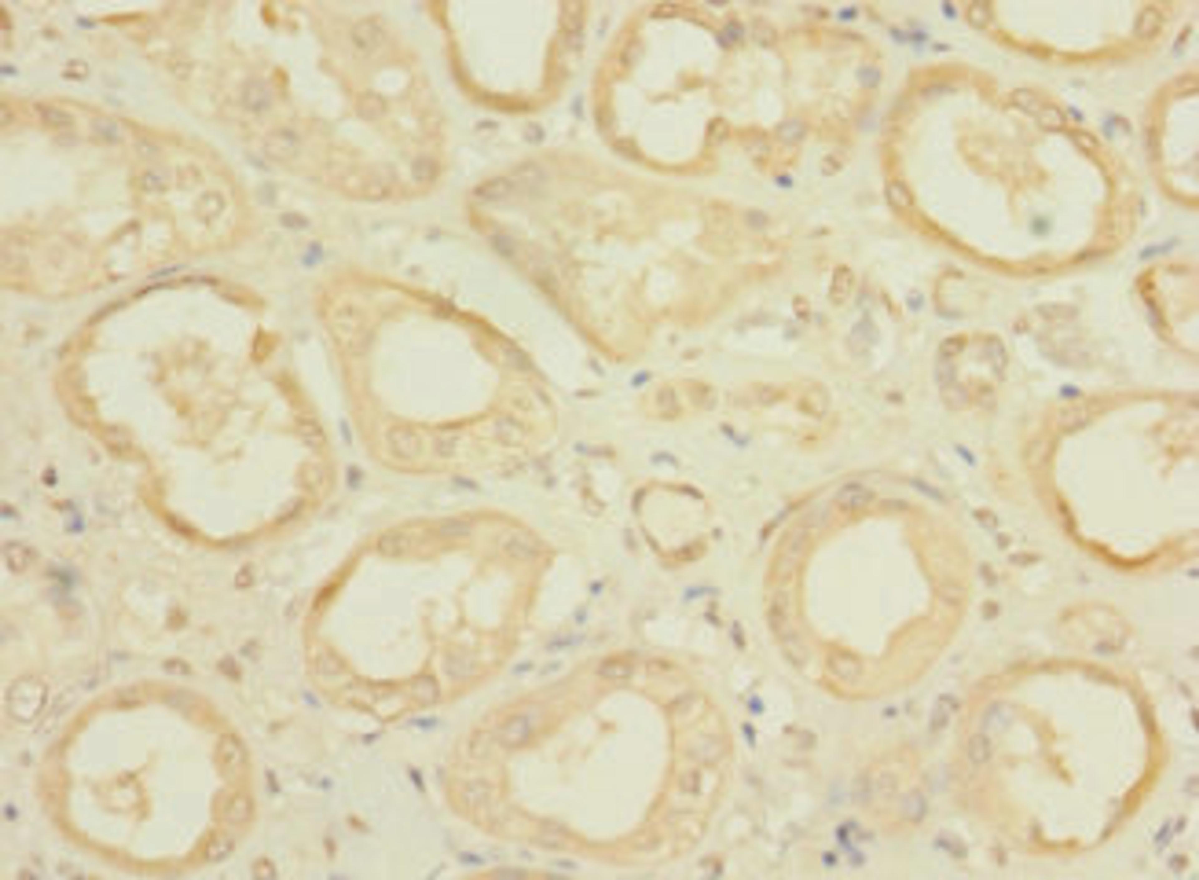 Immunohistochemistry of paraffin-embedded human kidney tissue using CSB-PA669847LA01HU at dilution of 1:100