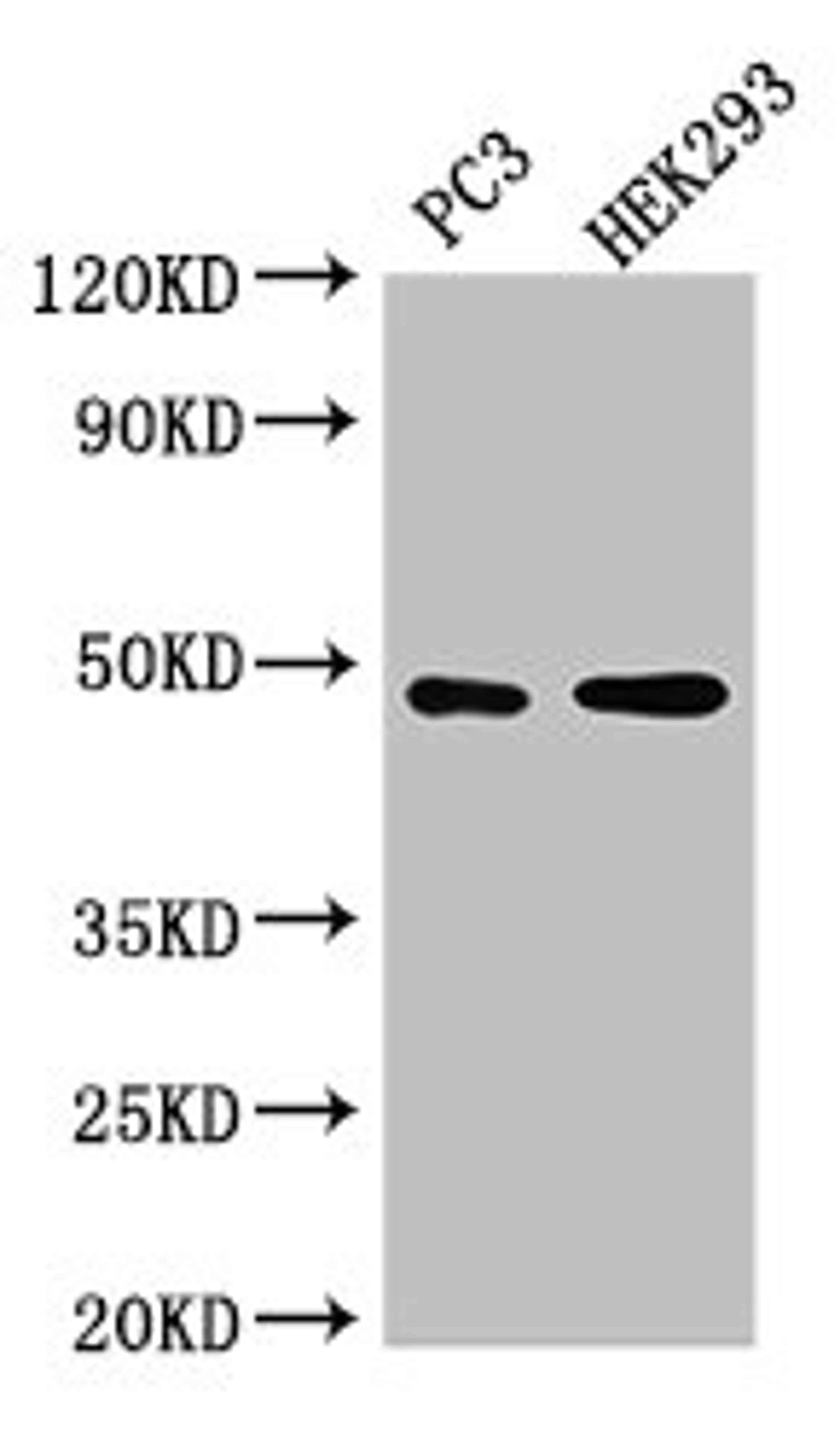 Western Blot. Positive WB detected in: PC-3 whole cell lysate, HEK293 whole cell lysate. All lanes: ACTR10 antibody at 3ug/ml. Secondary. Goat polyclonal to rabbit IgG at 1/50000 dilution. Predicted band size: 47 kDa. Observed band size: 47 kDa. 
