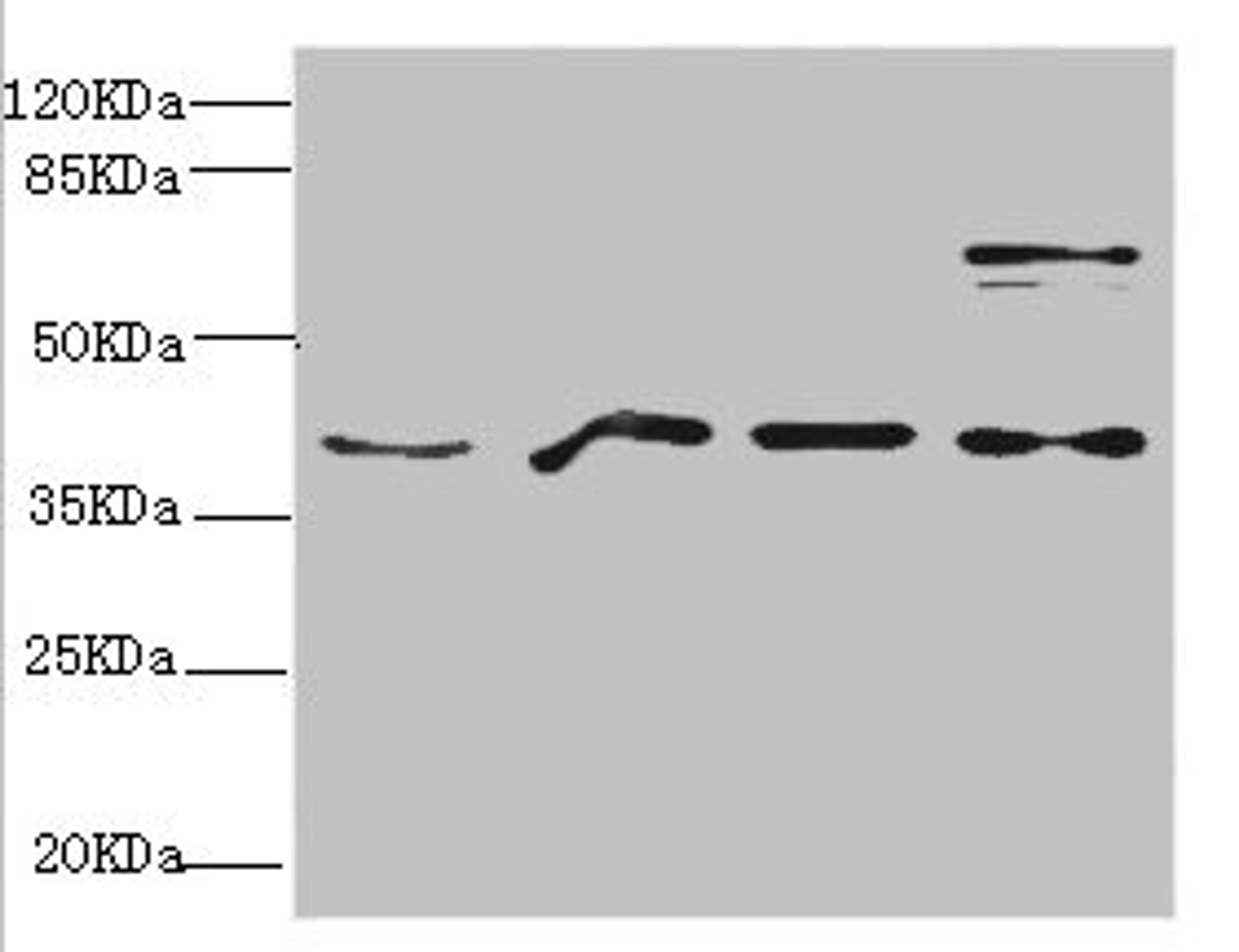 Western blot. All lanes: RAE1 antibody at 4.39ug/ml. Lane 1: Mouse brain tissue. Lane 2: HepG2 whole cell lysate. Lane 3: 293T whole cell lysate. Lane 4: Hela whole cell lysate. Secondary. Goat polyclonal to rabbit IgG at 1/10000 dilution. Predicted band size: 41 kDa. Observed band size: 41, 80 kDa. 