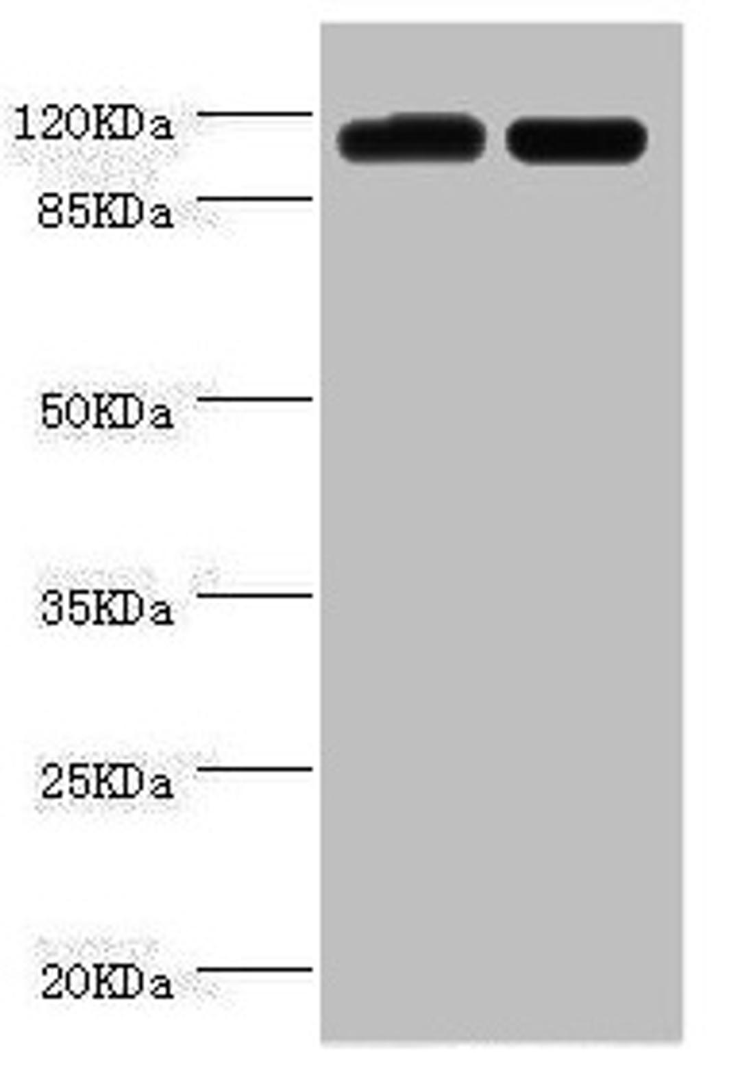 Western blot. All lanes: PITRM1 antibody at 2µg/ml. Lane 1: A549 whole cell lysate. Lane 2: Mouse kidney tissue. Secondary. Goat polyclonal to rabbit IgG at 1/10000 dilution. Predicted band size: 118, 107 kDa. Observed band size: 118 kDa