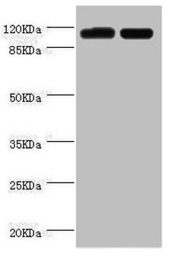 Western blot. All lanes: PITRM1 antibody at 2µg/ml. Lane 1: A549 whole cell lysate. Lane 2: Mouse kidney tissue. Secondary. Goat polyclonal to rabbit IgG at 1/10000 dilution. Predicted band size: 118, 107 kDa. Observed band size: 118 kDa