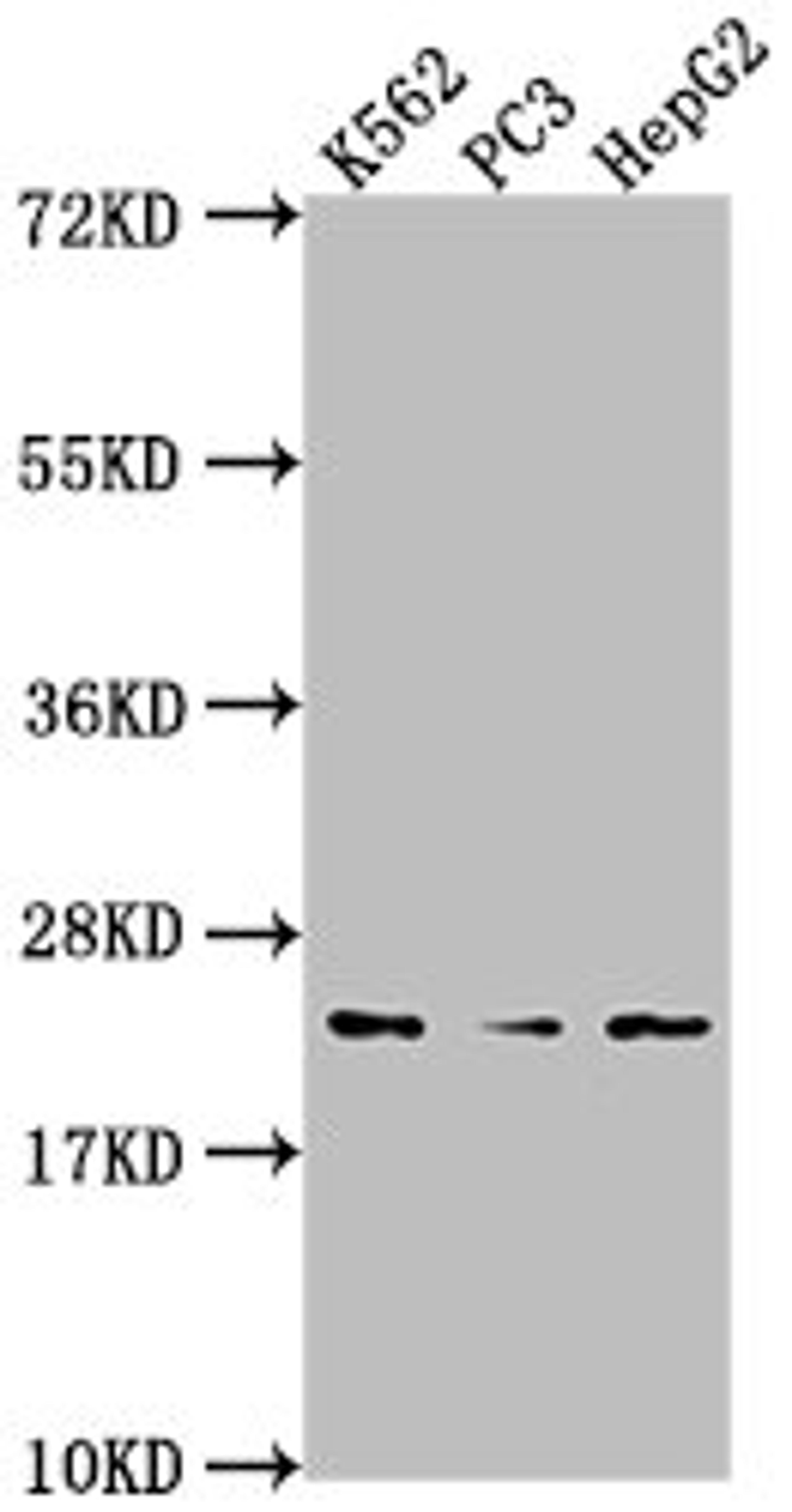 Western Blot. Positive WB detected in: K562 whole cell lysate, PC3 whole cell lysate, HepG2 whole cell lysate. All lanes: BLVRB antibody at 1:2000. Secondary. Goat polyclonal to rabbit IgG at 1/50000 dilution. Predicted band size: 23 kDa. Observed band size: 23 kDa. 