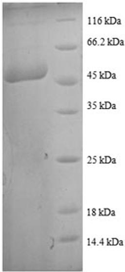 (Tris-Glycine gel) Discontinuous SDS-PAGE (reduced) with 5% enrichment gel and 15% separation gel.