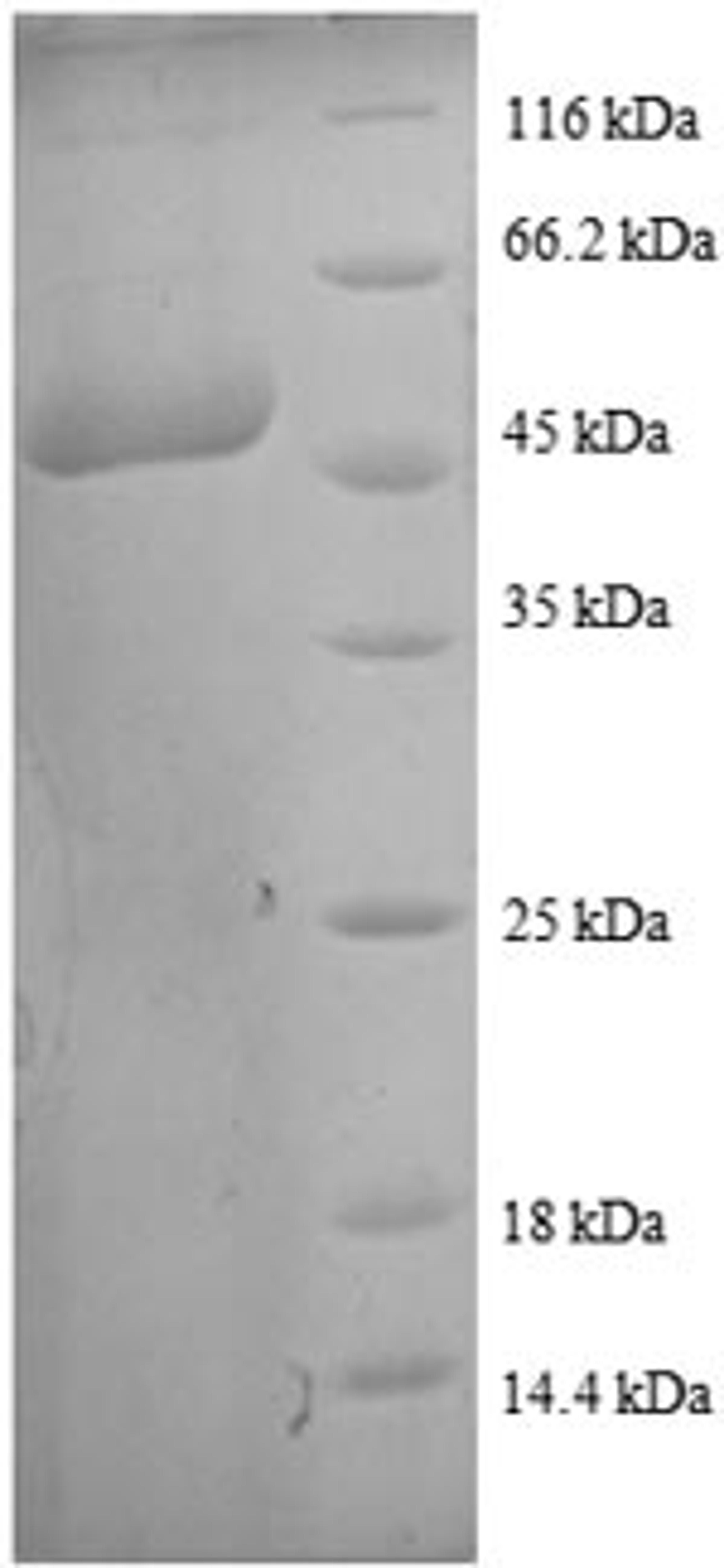 (Tris-Glycine gel) Discontinuous SDS-PAGE (reduced) with 5% enrichment gel and 15% separation gel.