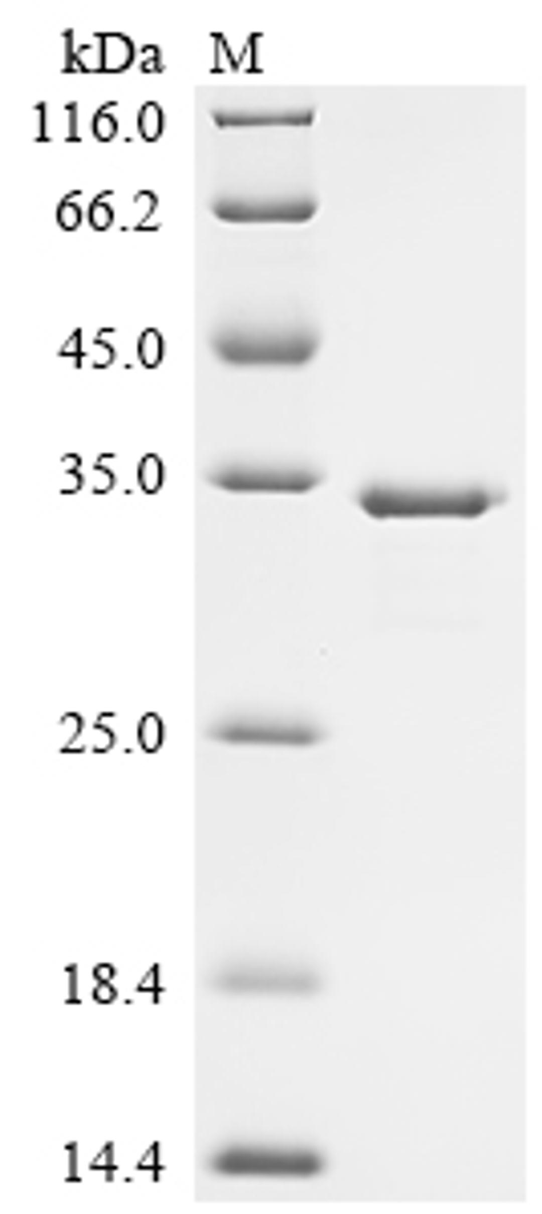 (Tris-Glycine gel) Discontinuous SDS-PAGE (reduced) with 5% enrichment gel and 15% separation gel.