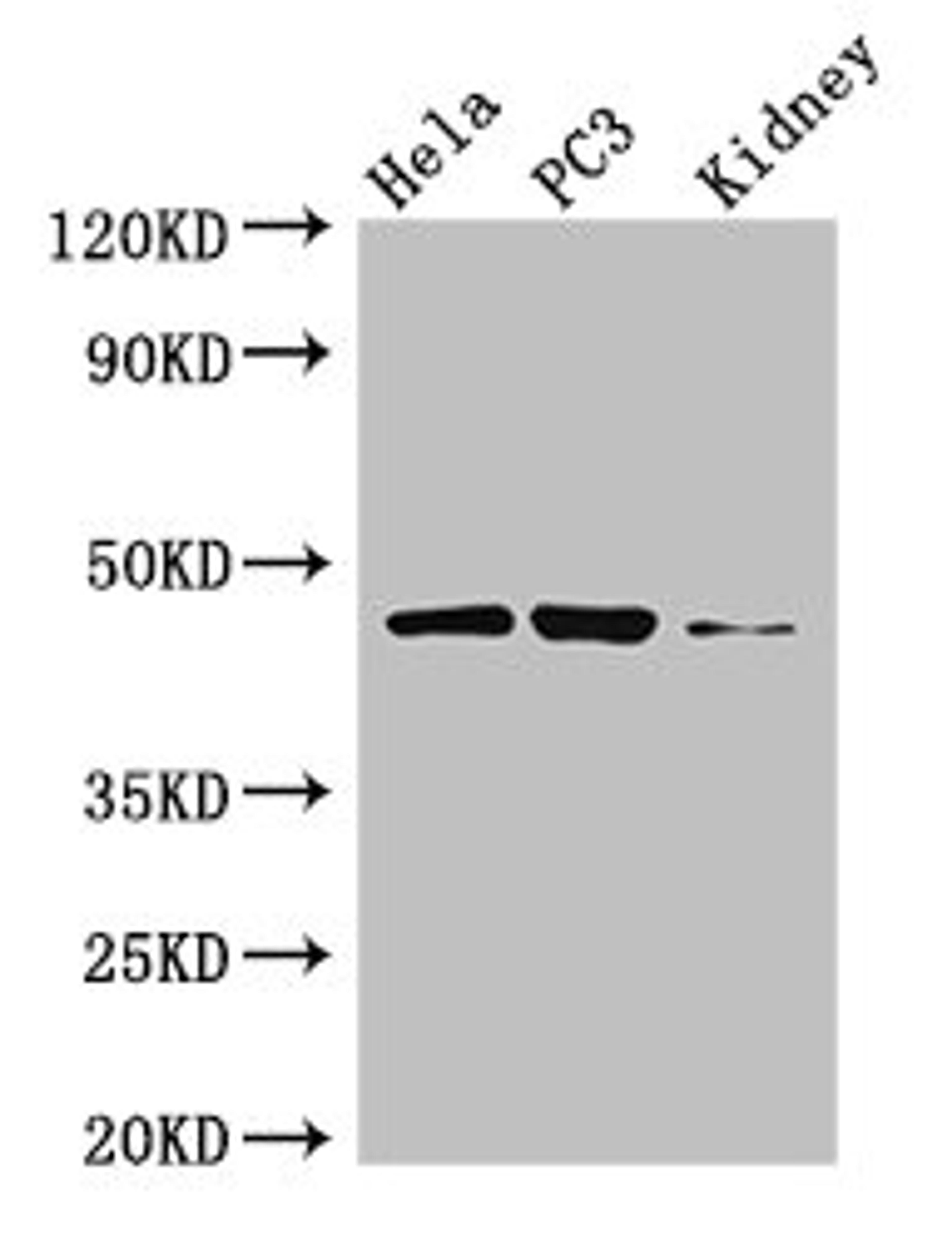 Western Blot. Positive WB detected in: Hela whole cell lysate, PC-3 whole cell lysate, Mouse kidney tissue. All lanes: GSK3B antibody at 3µg/ml. Secondary. Goat polyclonal to rabbit IgG at 1/50000 dilution. Predicted band size: 47, 49 kDa. Observed band size: 47 kDa