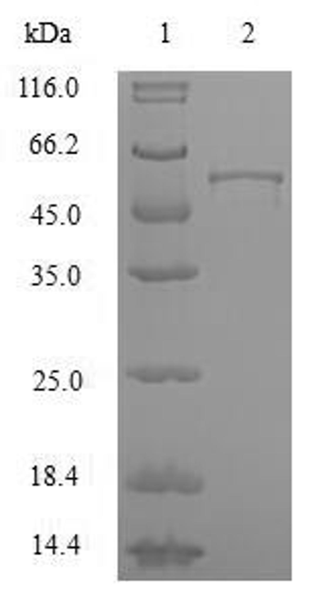 (Tris-Glycine gel) Discontinuous SDS-PAGE (reduced) with 5% enrichment gel and 15% separation gel.