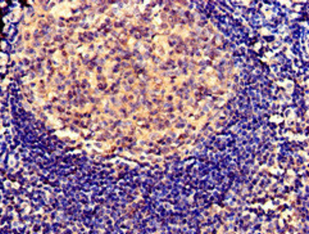 Immunohistochemistry of paraffin-embedded human tonsil tissue using CSB-PA021086LA01HU at dilution of 1:100