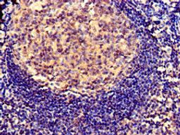 Immunohistochemistry of paraffin-embedded human tonsil tissue using CSB-PA021086LA01HU at dilution of 1:100