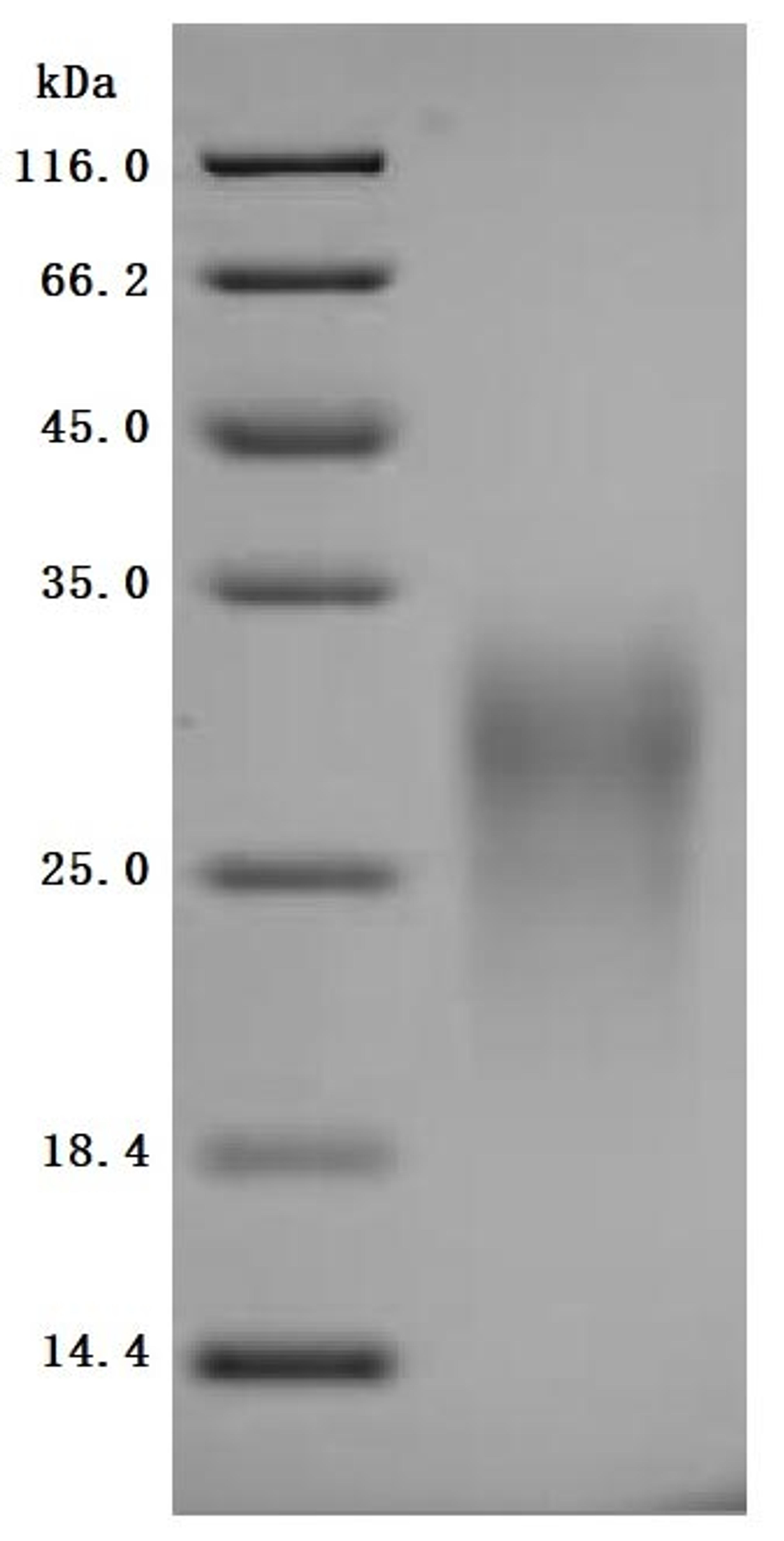 (Tris-Glycine gel) Discontinuous SDS-PAGE (reduced) with 5% enrichment gel and 15% separation gel.