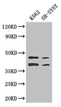 Western Blot. Positive WB detected in: K562 whole cell lysate, SH-SY5Y whole cell lysate. All lanes: AIM2 antibody at 2.7ug/ml. Secondary. Goat polyclonal to rabbit IgG at 1/50000 dilution. Predicted band size: 39 kDa. Observed band size: 39, 45 kDa. 