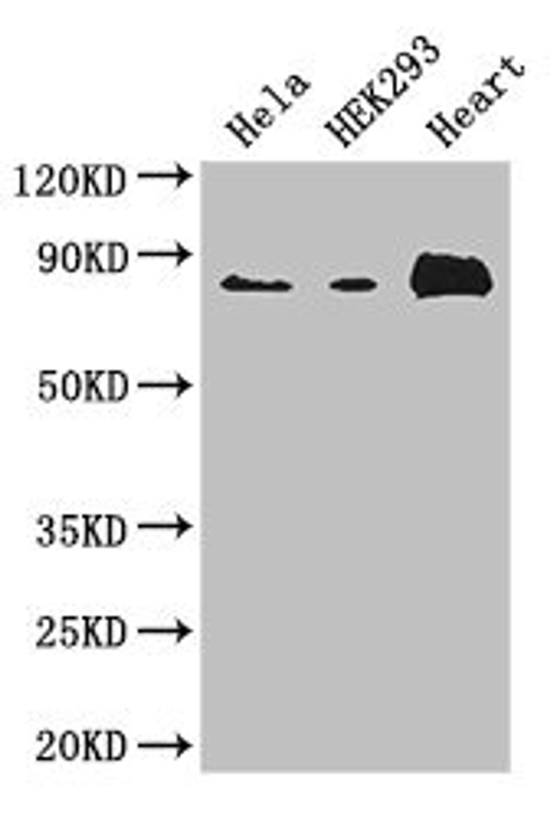 Western Blot. Positive WB detected in: Hela whole cell lysate, HEK293 whole cell lysate, Mouse heart tissue. All lanes: ABLIM1 antibody at 3.4ug/ml. Secondary. Goat polyclonal to rabbit IgG at 1/50000 dilution. Predicted band size: 88, 82, 49, 47, 53, 85 kDa. Observed band size: 88 kDa. 