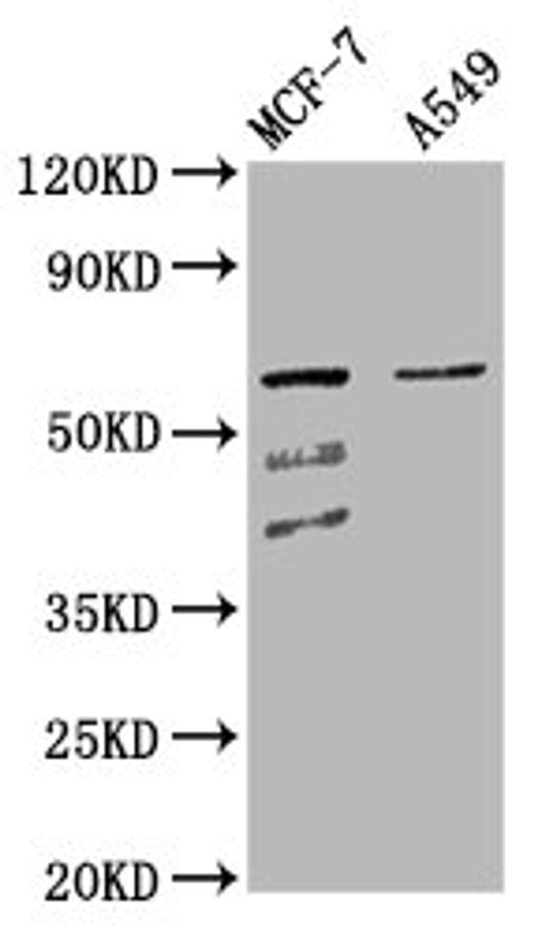Western Blot. Positive WB detected in: MCF-7 whole cell lysate, A549 whole cell lysate. All lanes: SLC22A5 antibody at 4.3µg/ml. Secondary. Goat polyclonal to rabbit IgG at 1/50000 dilution. Predicted band size: 63, 25, 66 kDa. Observed band size: 63 kDa