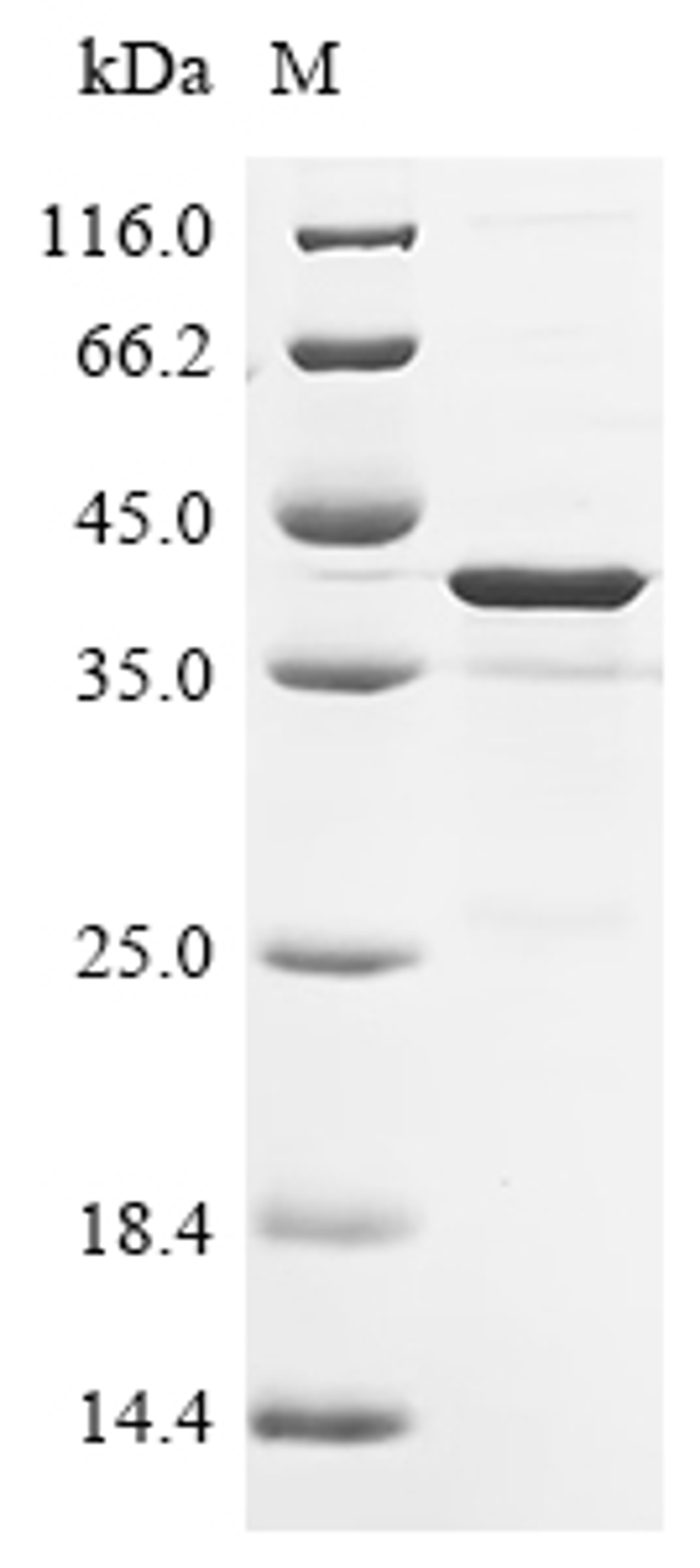 (Tris-Glycine gel) Discontinuous SDS-PAGE (reduced) with 5% enrichment gel and 15% separation gel.