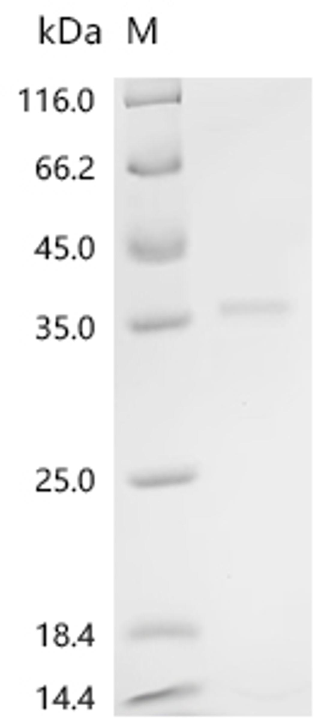 (Tris-Glycine gel) Discontinuous SDS-PAGE (reduced) with 5% enrichment gel and 15% separation gel.