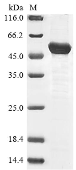 (Tris-Glycine gel) Discontinuous SDS-PAGE (reduced) with 5% enrichment gel and 15% separation gel.