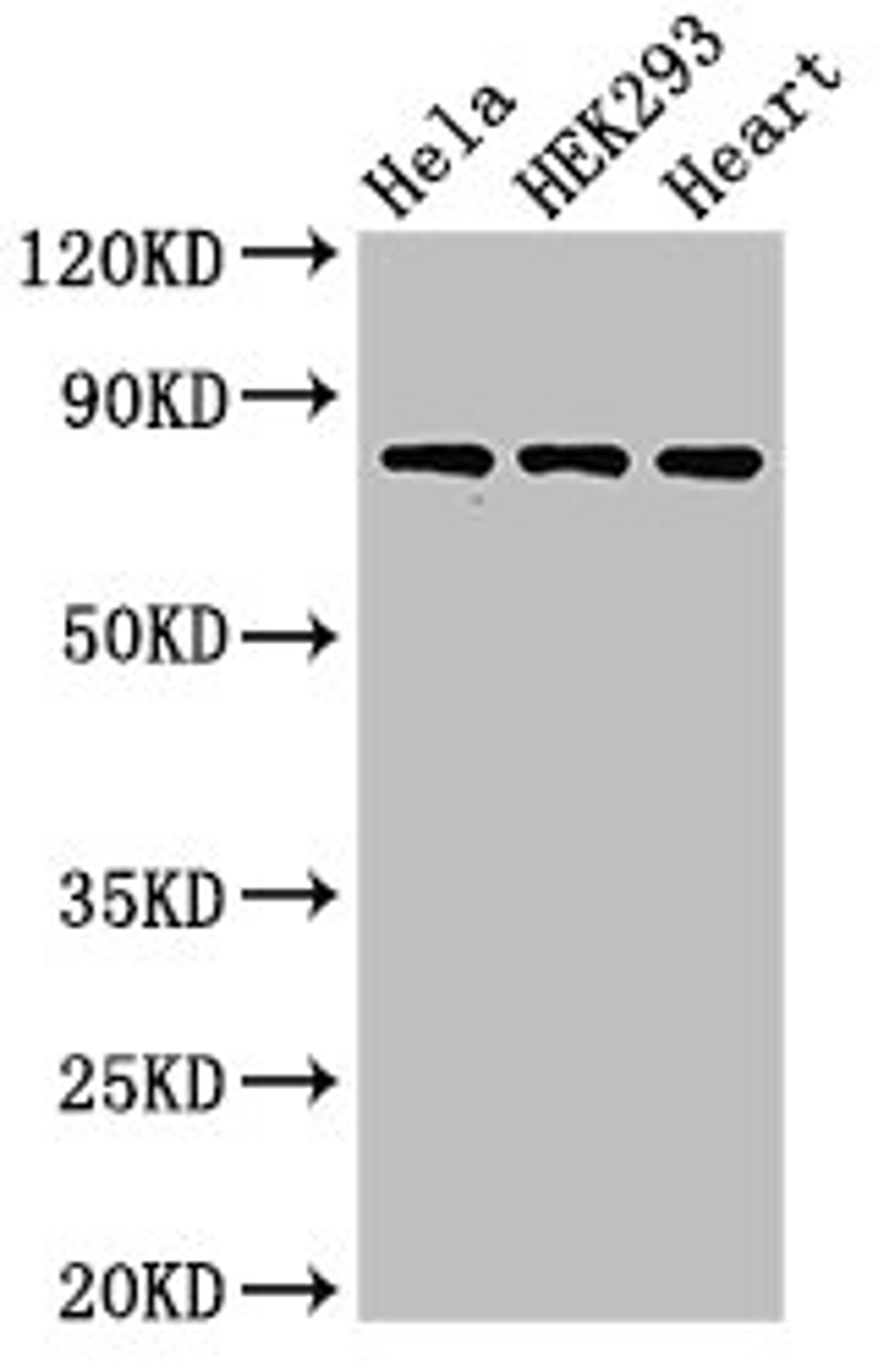 Western Blot. Positive WB detected in: Hela whole cell lysate, HEK293 whole cell lysate, Rat heart tissue. All lanes: C1R antibody at 3ug/ml. Secondary. Goat polyclonal to rabbit IgG at 1/50000 dilution. Predicted band size: 81 kDa. Observed band size: 81 kDa. 