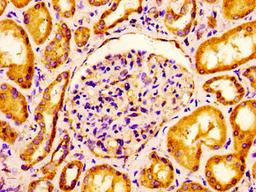 Immunohistochemistry of paraffin-embedded human kidney tissue using CSB-PA005508LA01HU at dilution of 1:100