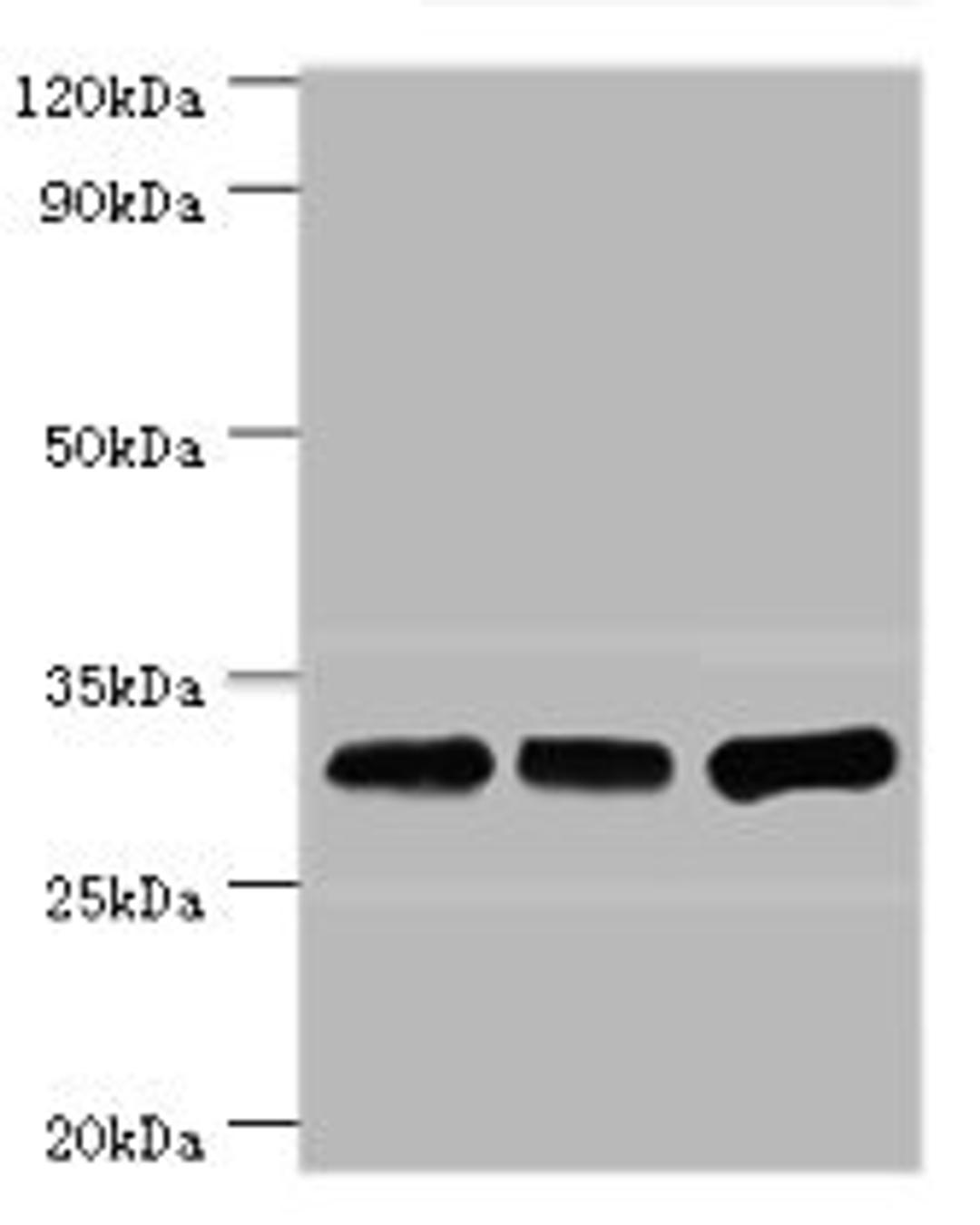 Western blot. All lanes: HNRNPA0 antibody at 12ug/ml. Lane 1: Mouse brain tissue. Lane 2: Hela whole cell lysate. Lane 3: Jurkat whole cell lysate. Secondary. Goat polyclonal to rabbit IgG at 1/10000 dilution. Predicted band size: 31 kDa. Observed band size: 31 kDa. 