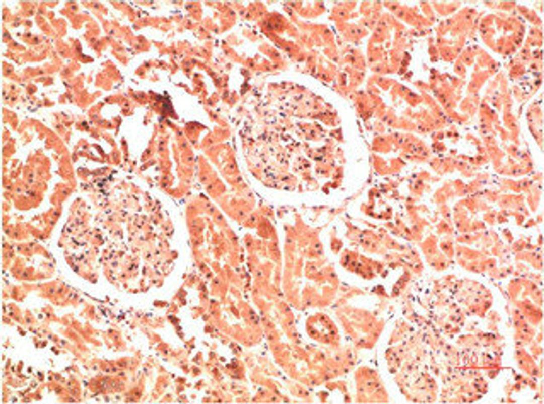 Immunohistochemical analysis of paraffin-embedded Human Kidney Tissue using Collagen IV  Mouse mAb diluted at 1:200.