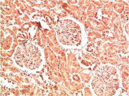Immunohistochemical analysis of paraffin-embedded Human Kidney Tissue using Collagen IV  Mouse mAb diluted at 1:200.