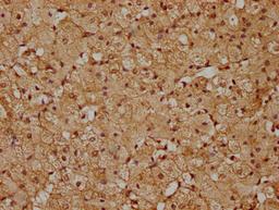 IHC image of CSB-PA819455LA01HU diluted at 1:200 and staining in paraffin-embedded human adrenal gland tissue performed on a Leica BondTM system. After dewaxing and hydration, antigen retrieval was mediated by high pressure in a citrate buffer (pH 6.0). Section was blocked with 10% normal goat serum 30min at RT. Then primary antibody (1% BSA) was incubated at 4°C overnight. The primary is detected by a biotinylated secondary antibody and visualized using an HRP conjugated SP system.