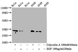Western Blot. Positive WB detected in Hela whole cell lysate,A549 whole cell lysate(treated with Calyculin A or EGF). All lanes Phospho-CDK1/CDK2/CDK3 antibody at 0.76μg/ml. Secondary. Goat polyclonal to rabbit IgG at 1/50000 dilution. Predicted band size: 34 KDa. Observed band size: 34 KDa. 