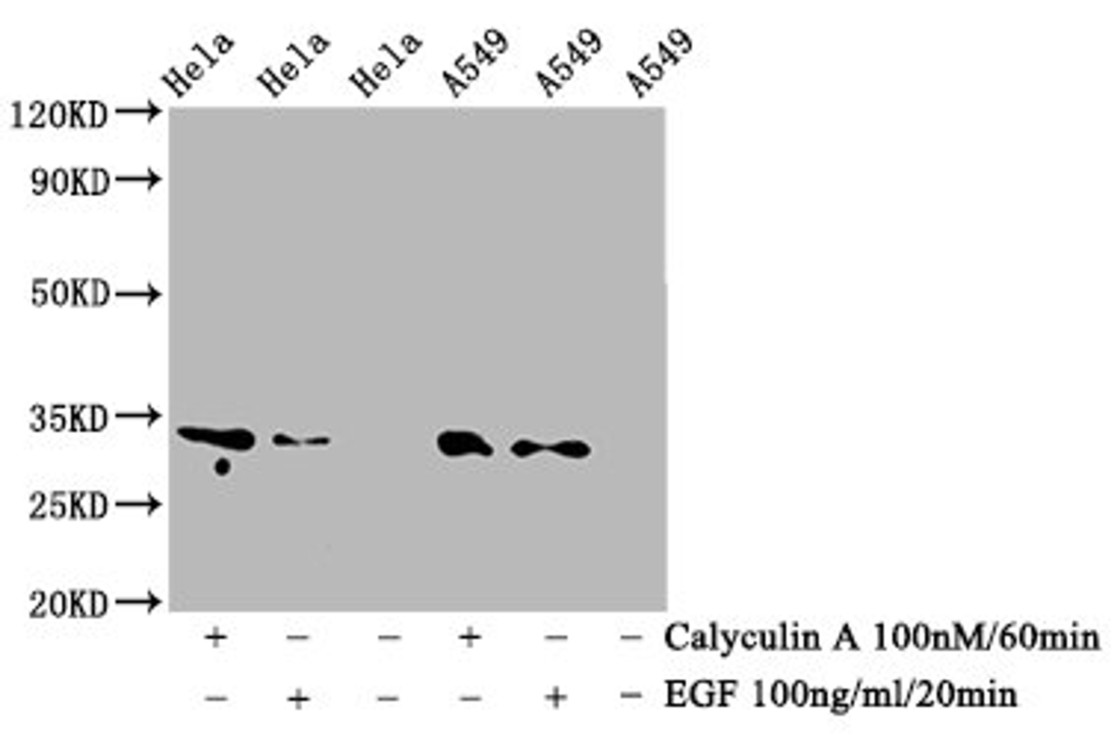 Western Blot. Positive WB detected in Hela whole cell lysate,A549 whole cell lysate(treated with Calyculin A or EGF). All lanes Phospho-CDK1/CDK2/CDK3 antibody at 0.76μg/ml. Secondary. Goat polyclonal to rabbit IgG at 1/50000 dilution. Predicted band size: 34 KDa. Observed band size: 34 KDa. 