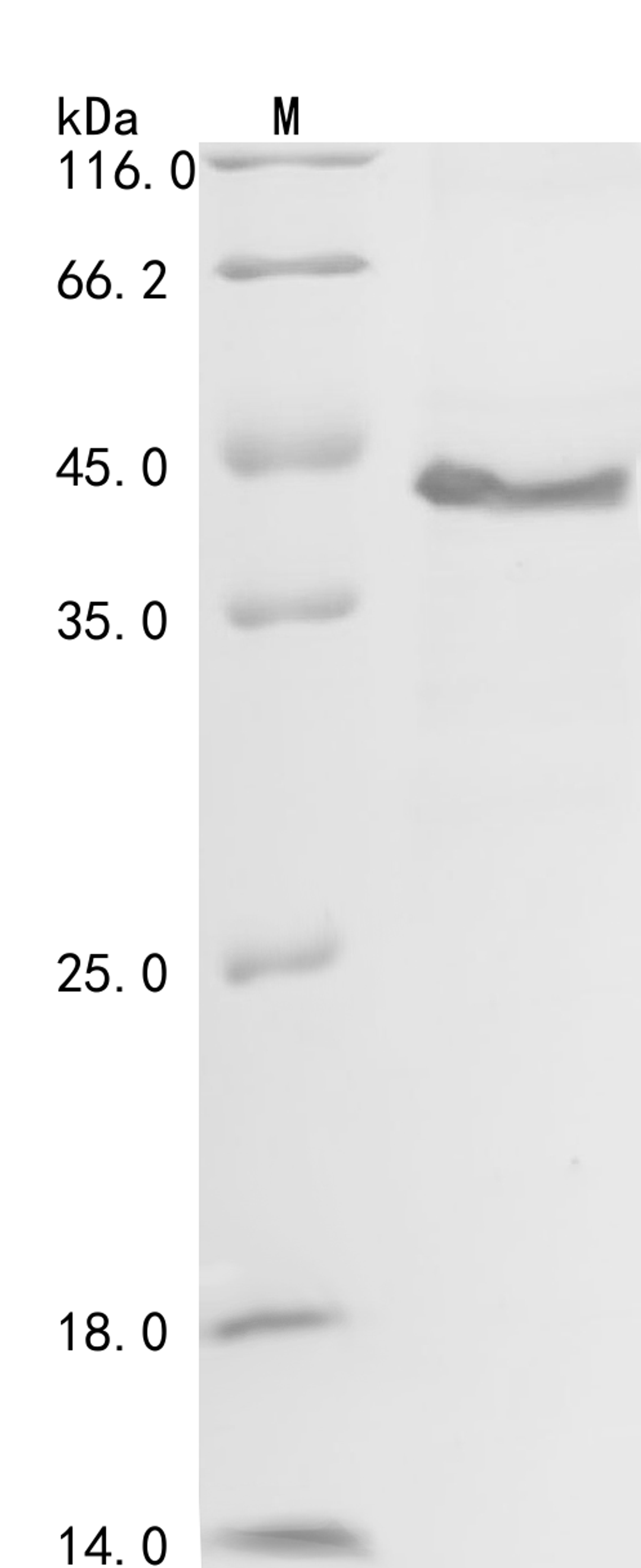 (Tris-Glycine gel) Discontinuous SDS-PAGE (reduced) with 5% enrichment gel and 15% separation gel.