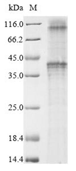 (Tris-Glycine gel) Discontinuous SDS-PAGE (reduced) with 5% enrichment gel and 15% separation gel.