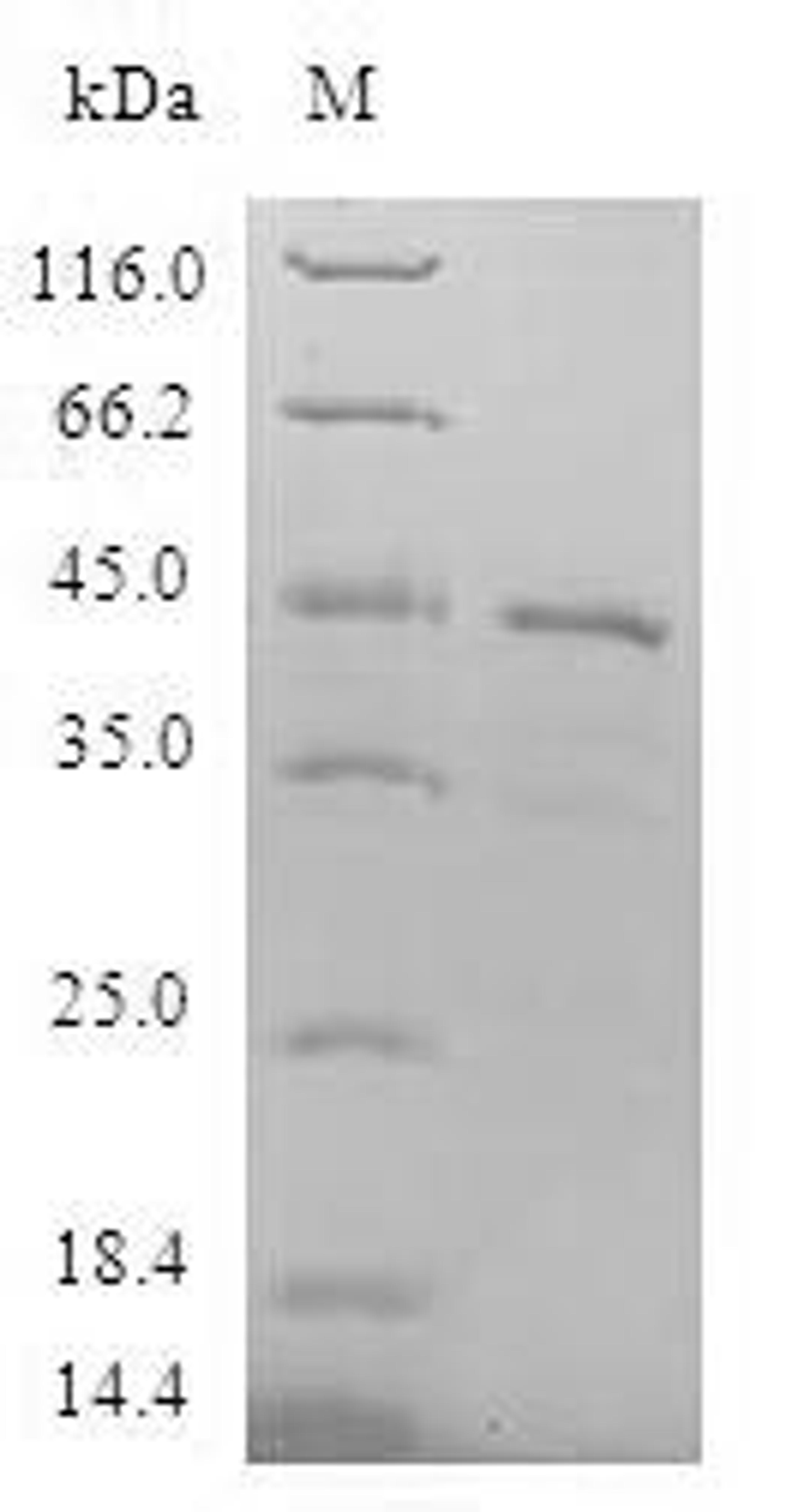 (Tris-Glycine gel) Discontinuous SDS-PAGE (reduced) with 5% enrichment gel and 15% separation gel.