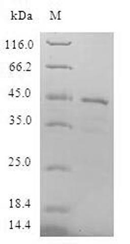 (Tris-Glycine gel) Discontinuous SDS-PAGE (reduced) with 5% enrichment gel and 15% separation gel.
