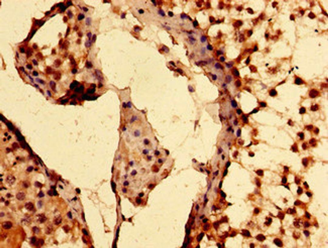 Immunohistochemistry of paraffin-embedded human testis tissue using CSB-PA860780LA01HU at dilution of 1:100