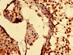 Immunohistochemistry of paraffin-embedded human testis tissue using CSB-PA860780LA01HU at dilution of 1:100