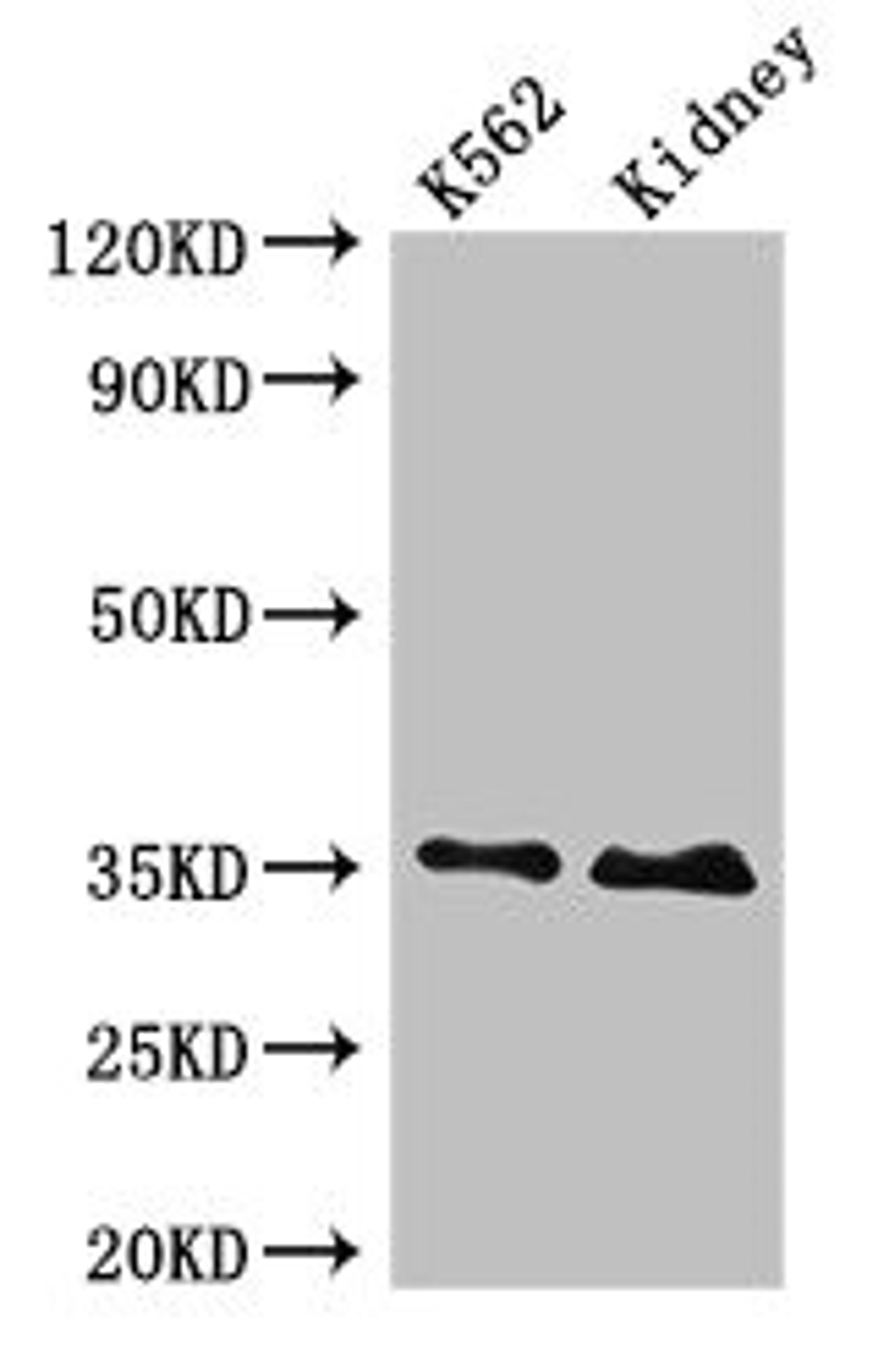 Western Blot. Positive WB detected in: K562 whole cell lysate, Rat kidney tissue. All lanes: TRADD antibody at 4ug/ml. Secondary. Goat polyclonal to rabbit IgG at 1/50000 dilution. Predicted band size: 35, 28 kDa. Observed band size: 35 kDa. 