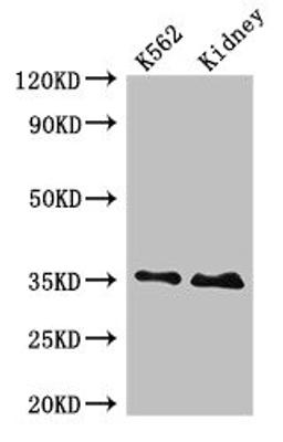 Western Blot. Positive WB detected in: K562 whole cell lysate, Rat kidney tissue. All lanes: TRADD antibody at 4ug/ml. Secondary. Goat polyclonal to rabbit IgG at 1/50000 dilution. Predicted band size: 35, 28 kDa. Observed band size: 35 kDa.