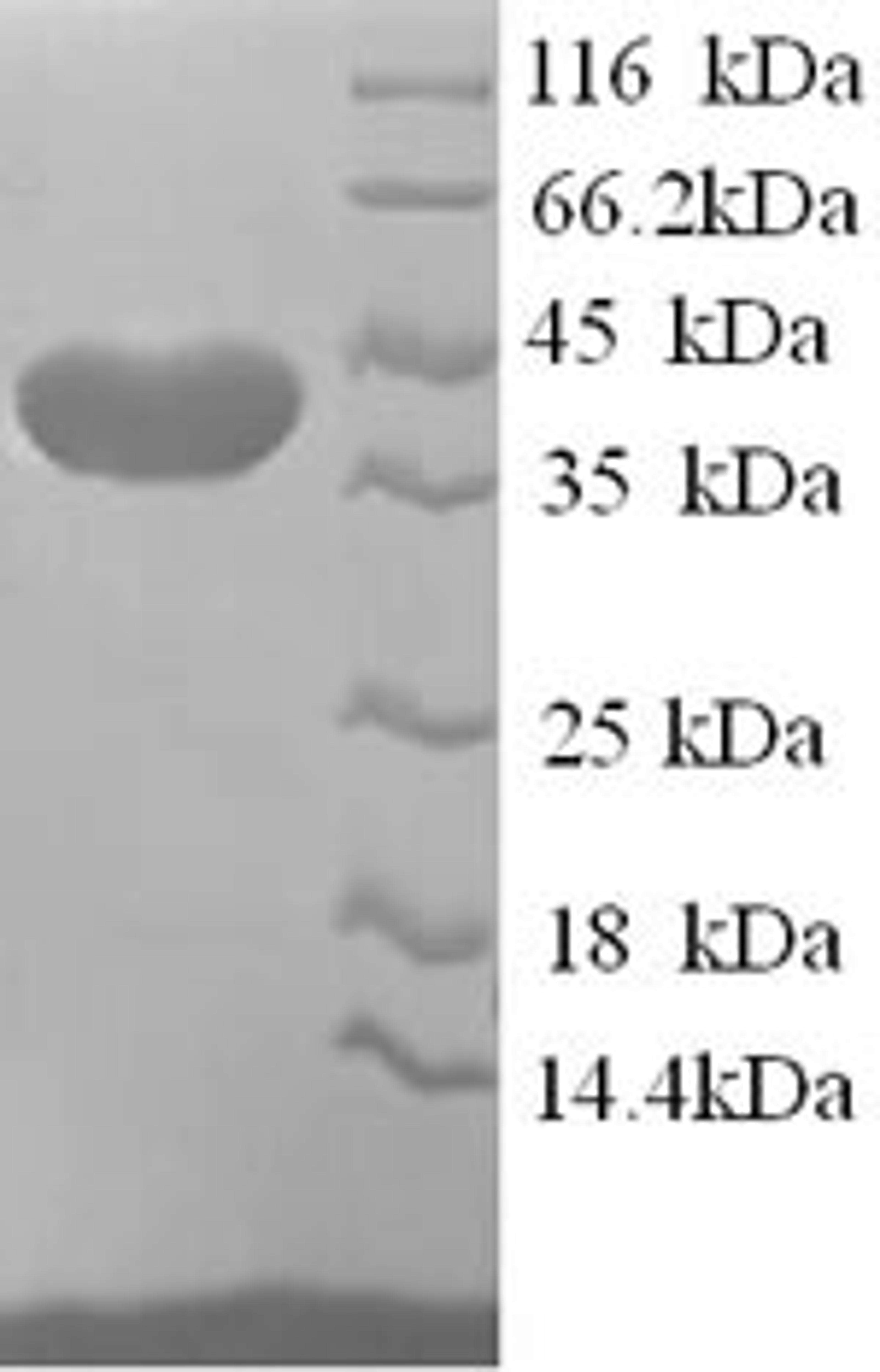 (Tris-Glycine gel) Discontinuous SDS-PAGE (reduced) with 5% enrichment gel and 15% separation gel.
