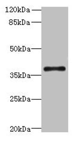 Western blot. All lanes: SUCNR1 antibody at 6µg/ml + Hela whole cell lysate. Secondary. Goat polyclonal to rabbit IgG at 1/10000 dilution. Predicted band size: 39 kDa. Observed band size: 39 kDa